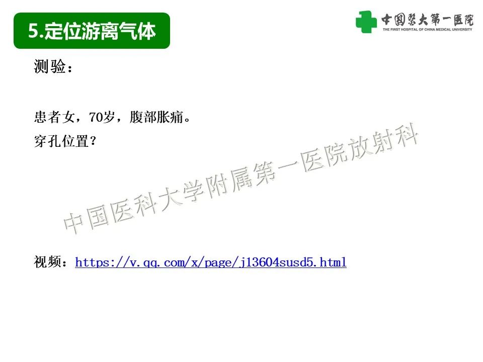 影像PPT - 【PPT】腹腔内游离气体从哪来？如何根据腹膜解剖确定穿孔位置-25