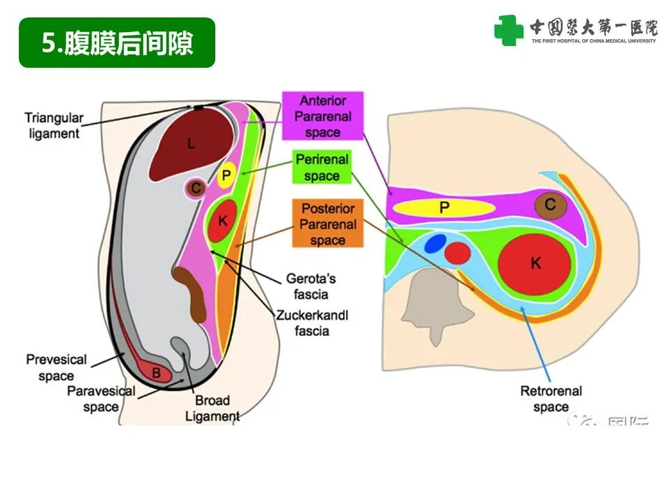 影像PPT - 【PPT】腹腔内游离气体从哪来？如何根据腹膜解剖确定穿孔位置-29