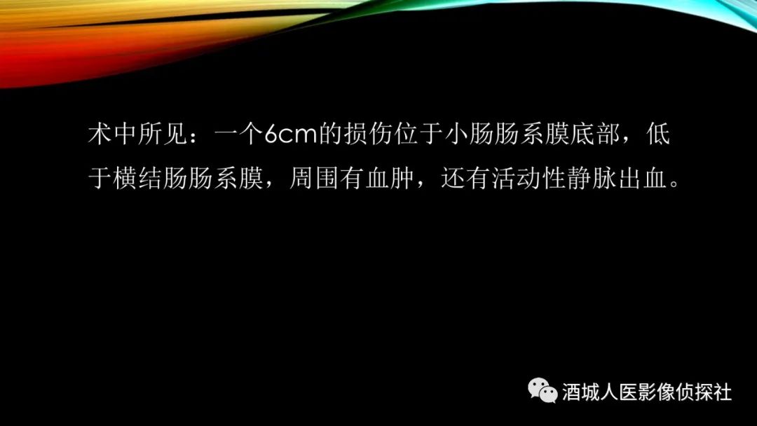 影像PPT - 【PPT】我们漏过外伤性肠系膜损伤吗？-4