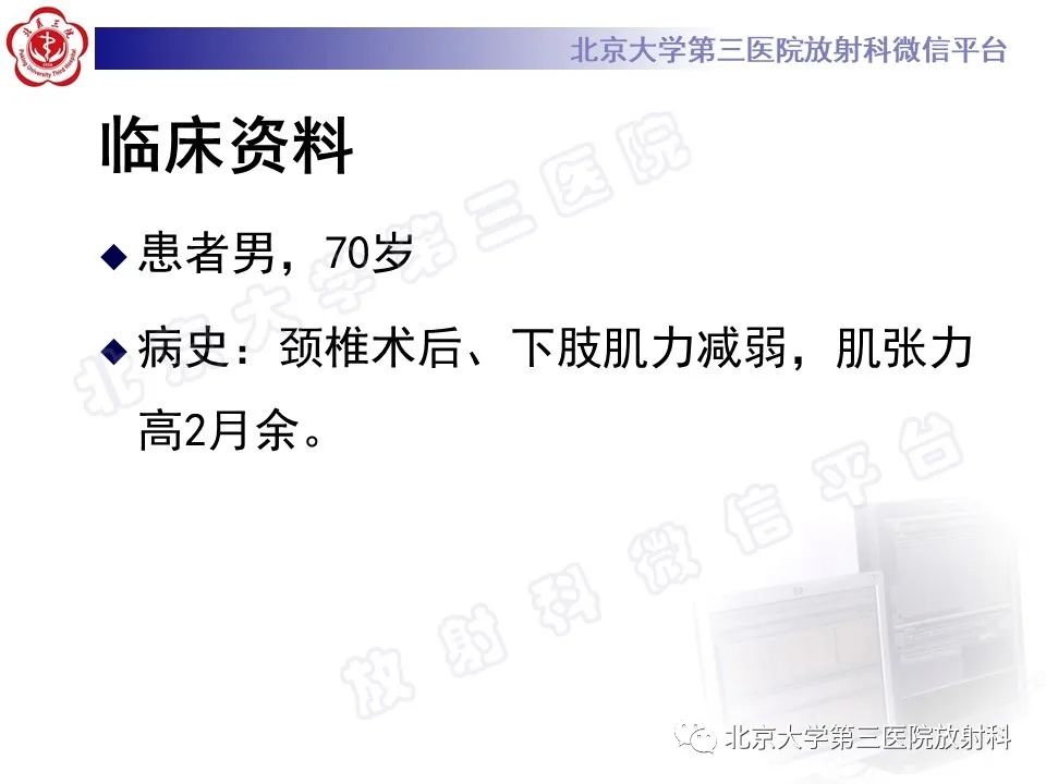 影像PPT - 【PPT】特发性肥厚性硬脊膜炎-2