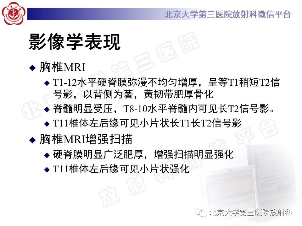 影像PPT - 【PPT】特发性肥厚性硬脊膜炎-6