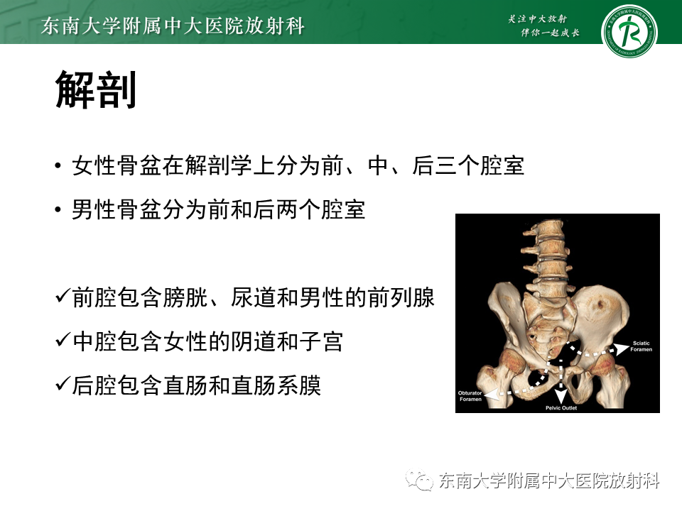 影像PPT - 【PPT】侵袭性血管黏液瘤-5