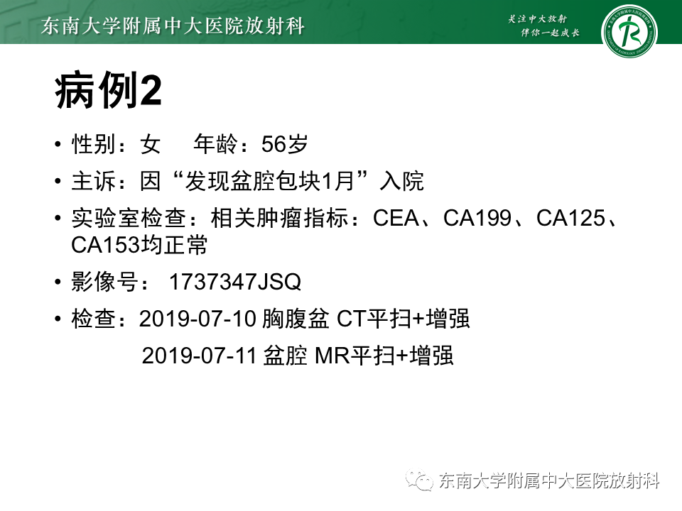 影像PPT - 【PPT】侵袭性血管黏液瘤-20