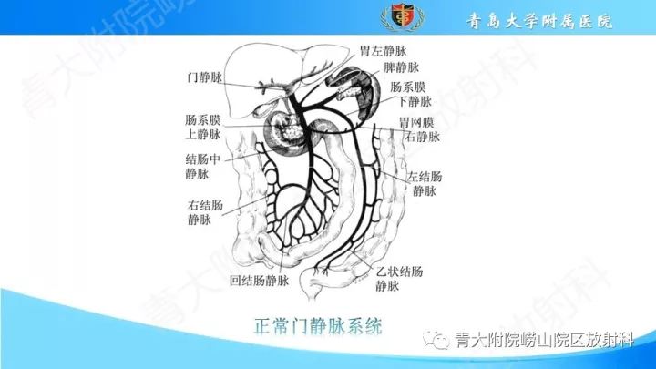 影像PPT - 【PPT】门静脉解剖及变异-3