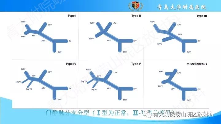 影像PPT - 【PPT】门静脉解剖及变异-6