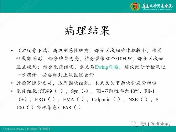 影像PPT - 【病例】股骨尤文肉瘤1例CT及MR影像-9