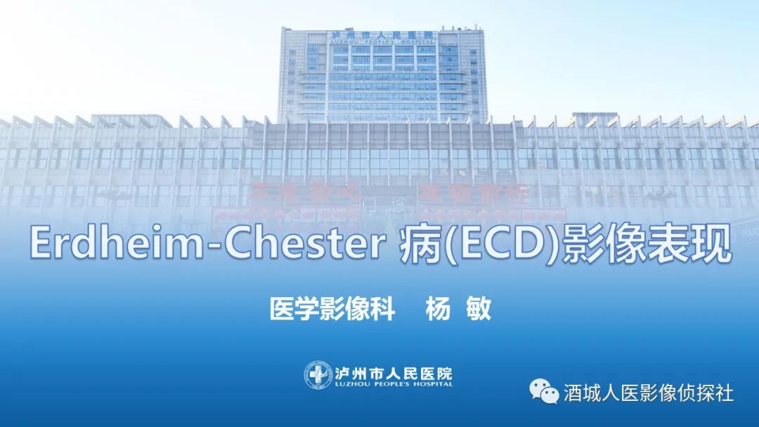 影像PPT - 【PPT】Erdheim-Chester 病（ECD）影像表现-6