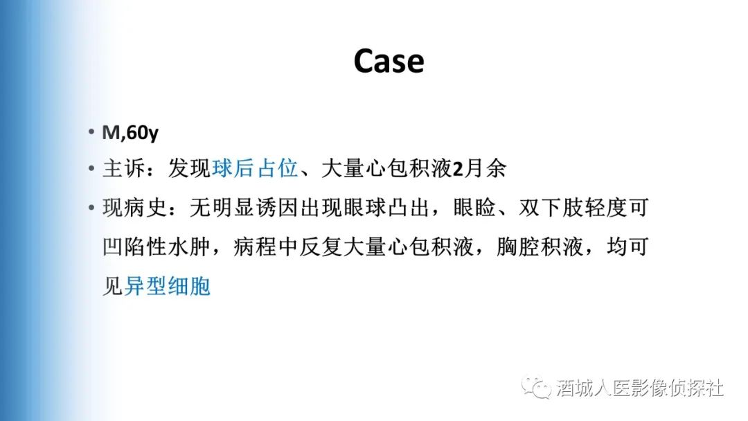 影像PPT - 【PPT】Erdheim-Chester 病（ECD）影像表现-1