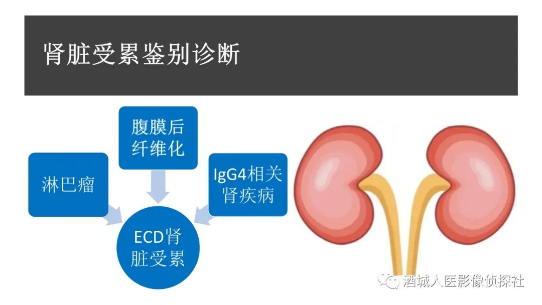 影像PPT - 【PPT】Erdheim-Chester 病（ECD）影像表现-27
