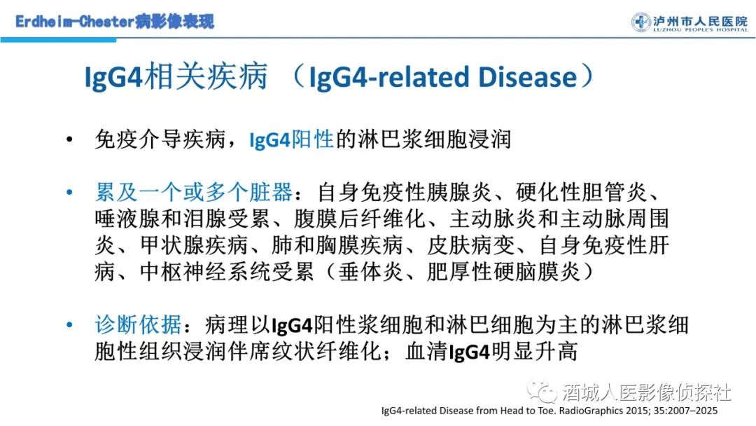 影像PPT - 【PPT】Erdheim-Chester 病（ECD）影像表现-33