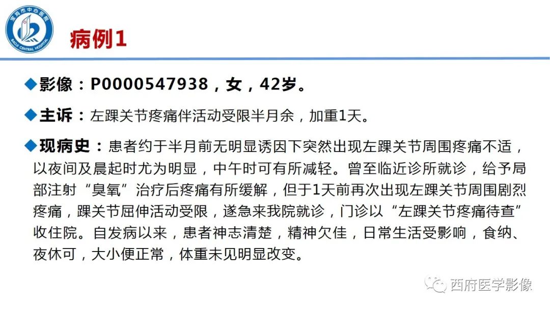 影像PPT - 【PPT】距后三角籽骨综合征影像诊断-2