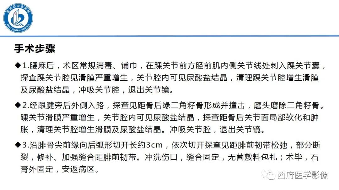 影像PPT - 【PPT】距后三角籽骨综合征影像诊断-21