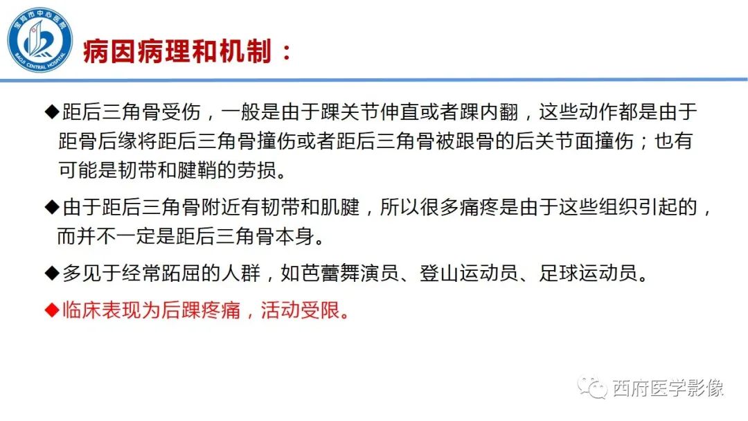 影像PPT - 【PPT】距后三角籽骨综合征影像诊断-30