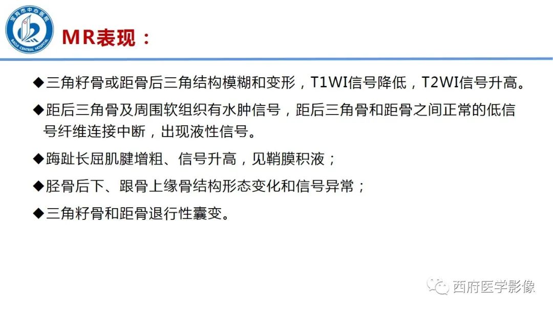 影像PPT - 【PPT】距后三角籽骨综合征影像诊断-32
