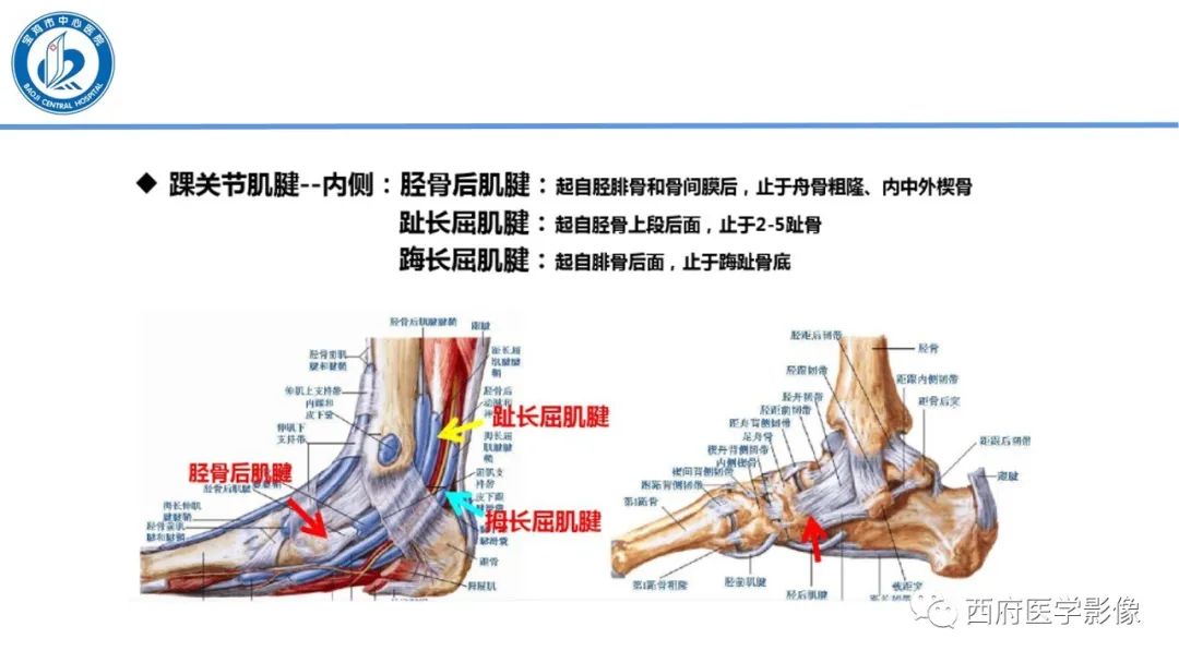 影像PPT - 【PPT】距后三角籽骨综合征影像诊断-33