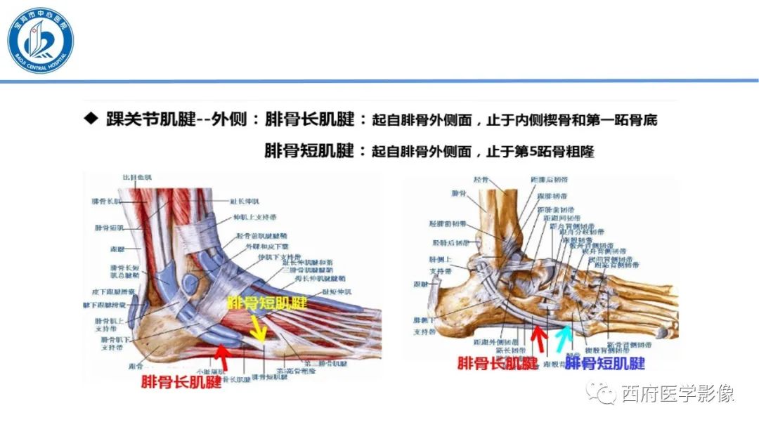 影像PPT - 【PPT】距后三角籽骨综合征影像诊断-34
