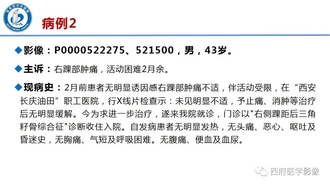 影像PPT - 【PPT】距后三角籽骨综合征影像诊断-2
