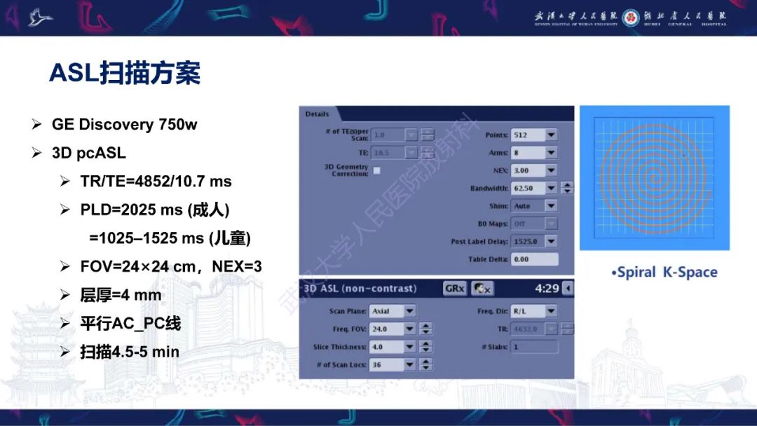 影像PPT - 【PPT】动脉自旋标记（ASL）伪影机制及图像解读-5