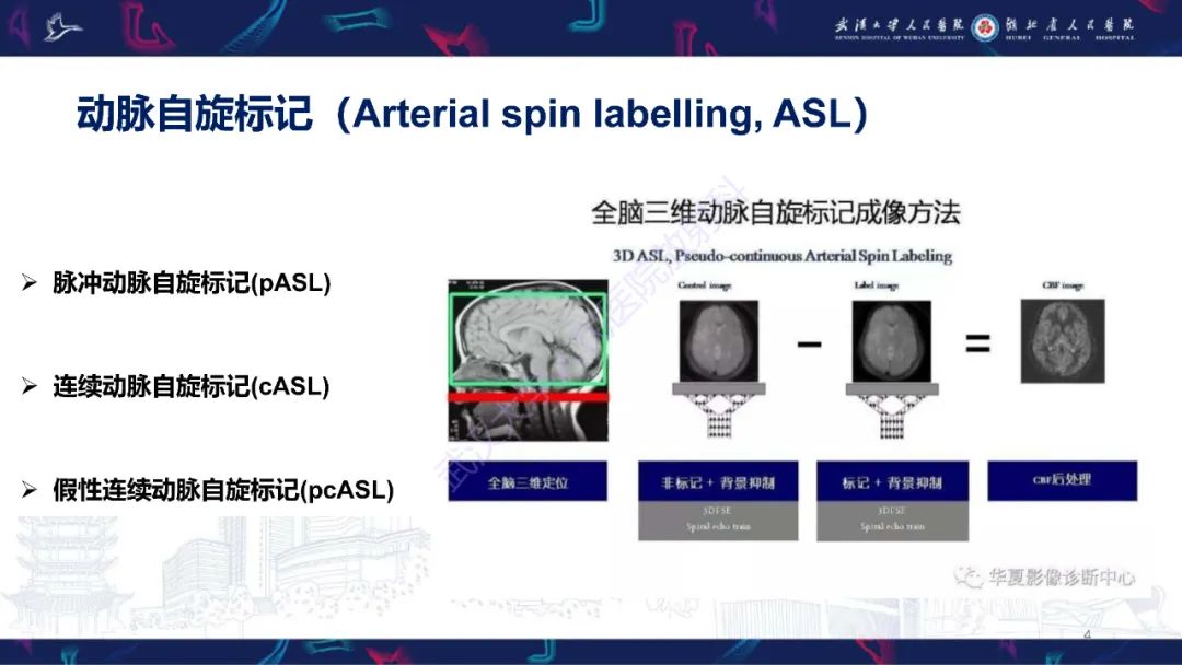 影像PPT - 【PPT】动脉自旋标记（ASL）伪影机制及图像解读-4