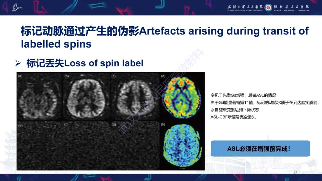 影像PPT - 【PPT】动脉自旋标记（ASL）伪影机制及图像解读-13