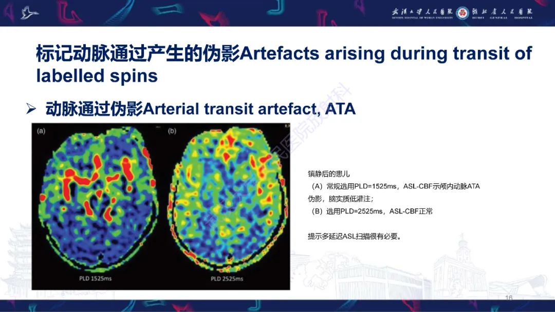 影像PPT - 【PPT】动脉自旋标记（ASL）伪影机制及图像解读-16