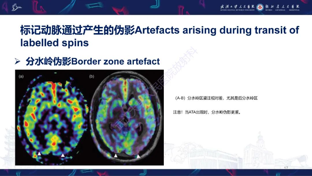影像PPT - 【PPT】动脉自旋标记（ASL）伪影机制及图像解读-17