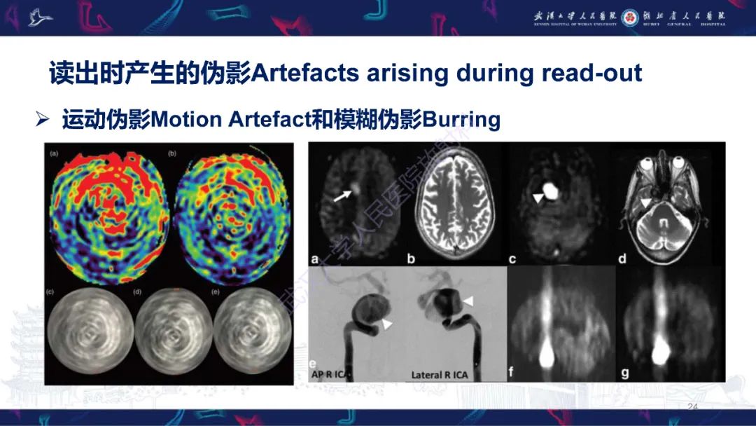 影像PPT - 【PPT】动脉自旋标记（ASL）伪影机制及图像解读-24