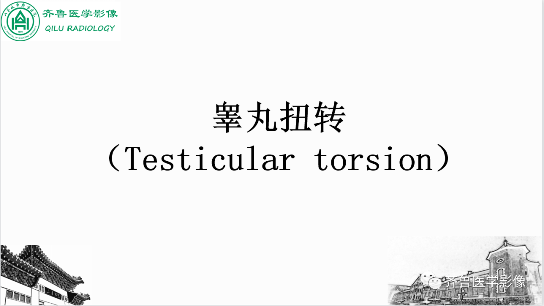 影像PPT - 【PPT】男性生殖系统疾病（睾丸扭转）-9