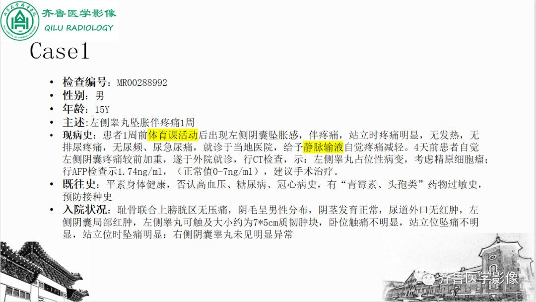 影像PPT - 【PPT】男性生殖系统疾病（睾丸扭转）-3