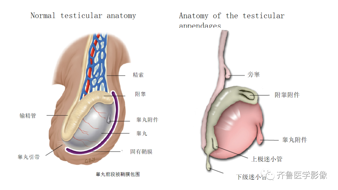 影像PPT - 【PPT】男性生殖系统疾病（睾丸扭转）-10