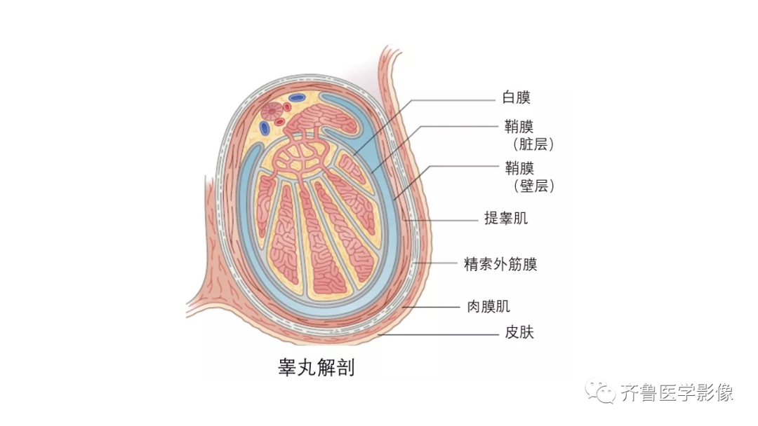 影像PPT - 【PPT】男性生殖系统疾病（睾丸扭转）-11