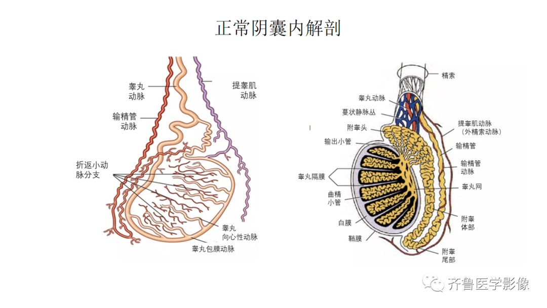 影像PPT - 【PPT】男性生殖系统疾病（睾丸扭转）-12