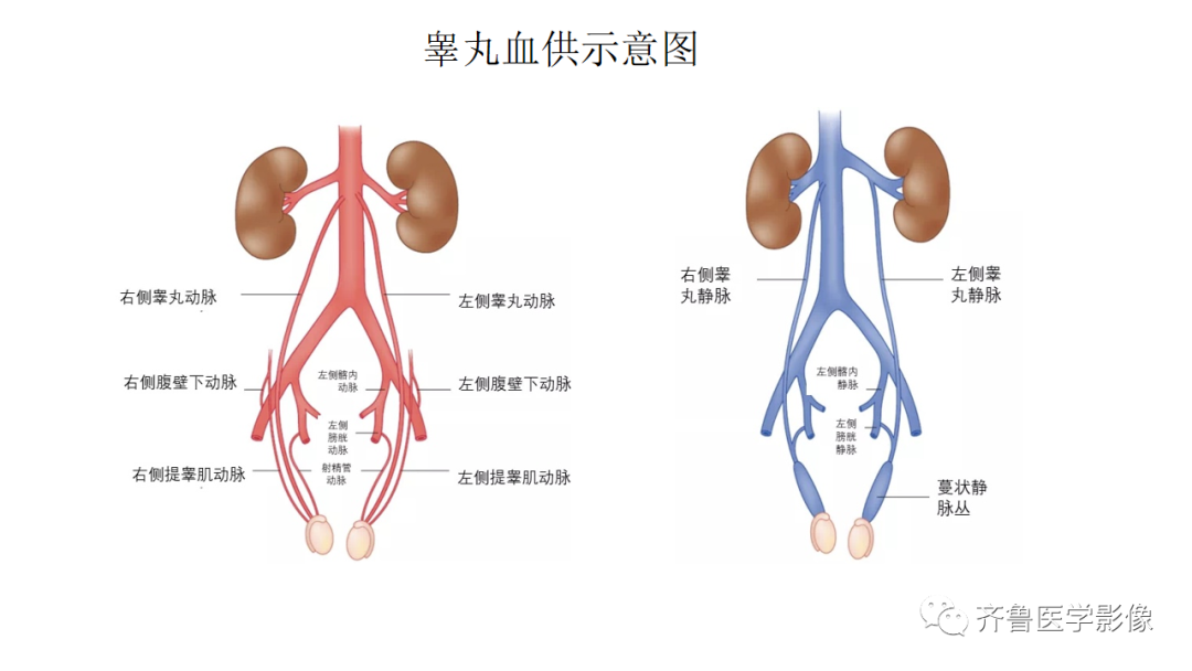 影像PPT - 【PPT】男性生殖系统疾病（睾丸扭转）-13