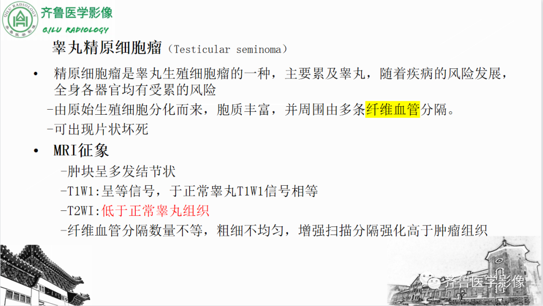 影像PPT - 【PPT】男性生殖系统疾病（睾丸扭转）-27