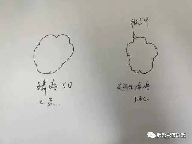 影像PPT - 【病例】重视肺部的那些小花小草-31 影像PPT - 【病例】重视肺部的那些小花小草-31