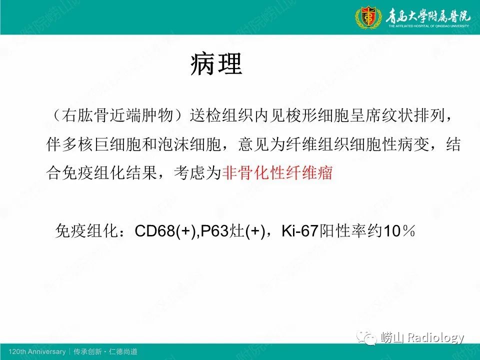 影像PPT - 【病例】非骨化性纤维瘤1例X线CT及MR影像-8