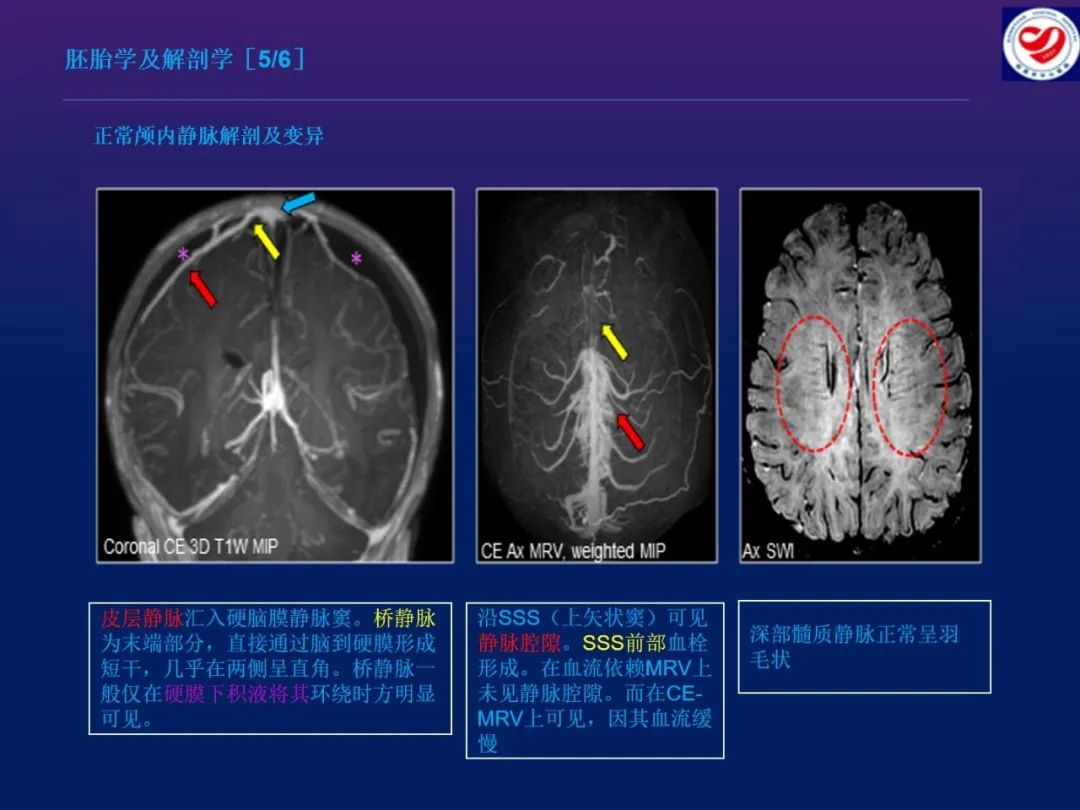 影像PPT - 【PPT】小儿脑静脉影像学：包括硬脑膜静脉窦-7