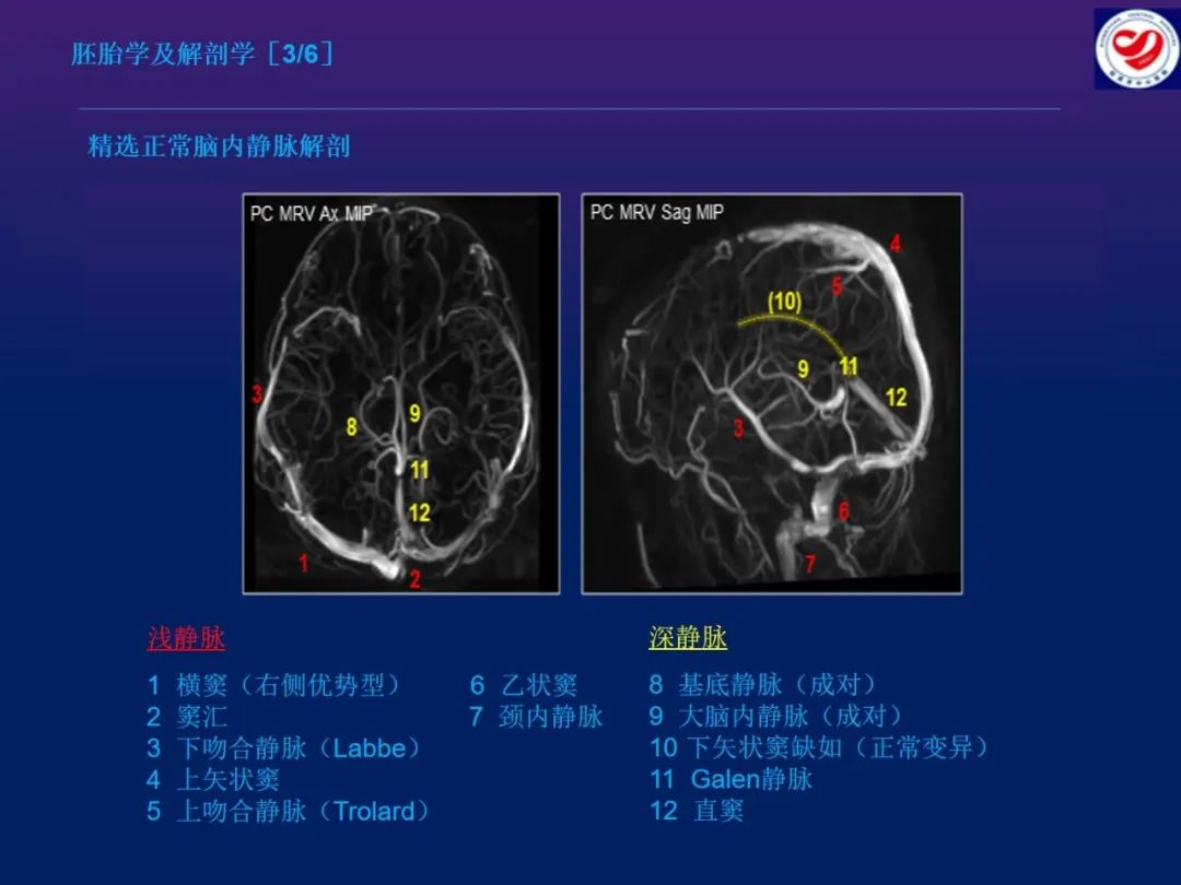 影像PPT - 【PPT】小儿脑静脉影像学：包括硬脑膜静脉窦-5