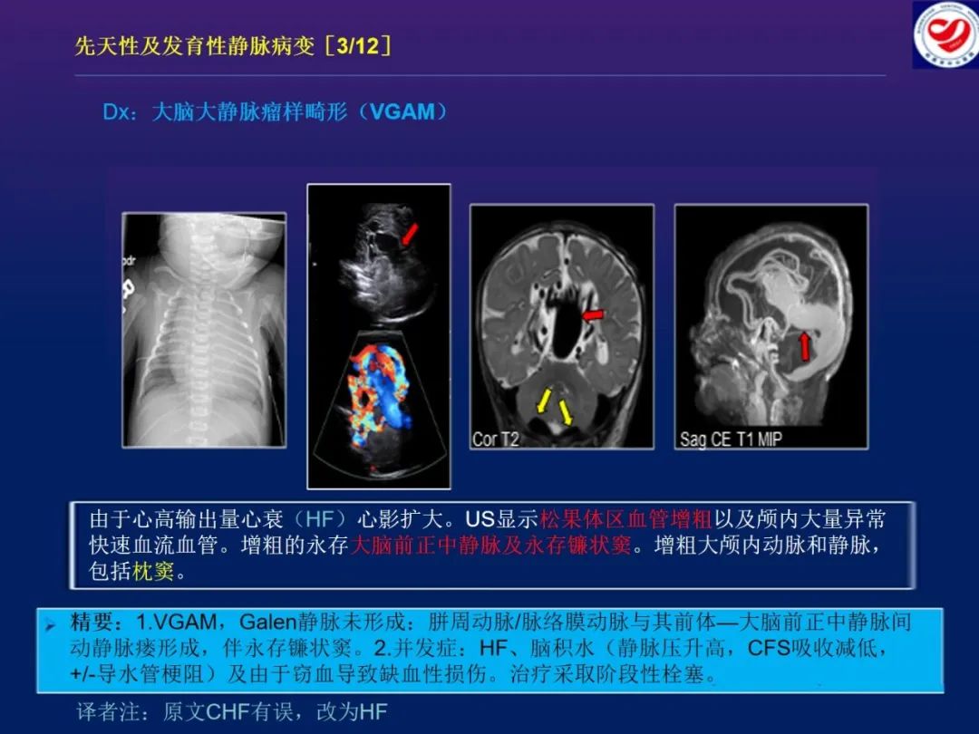 影像PPT - 【PPT】小儿脑静脉影像学：包括硬脑膜静脉窦-14