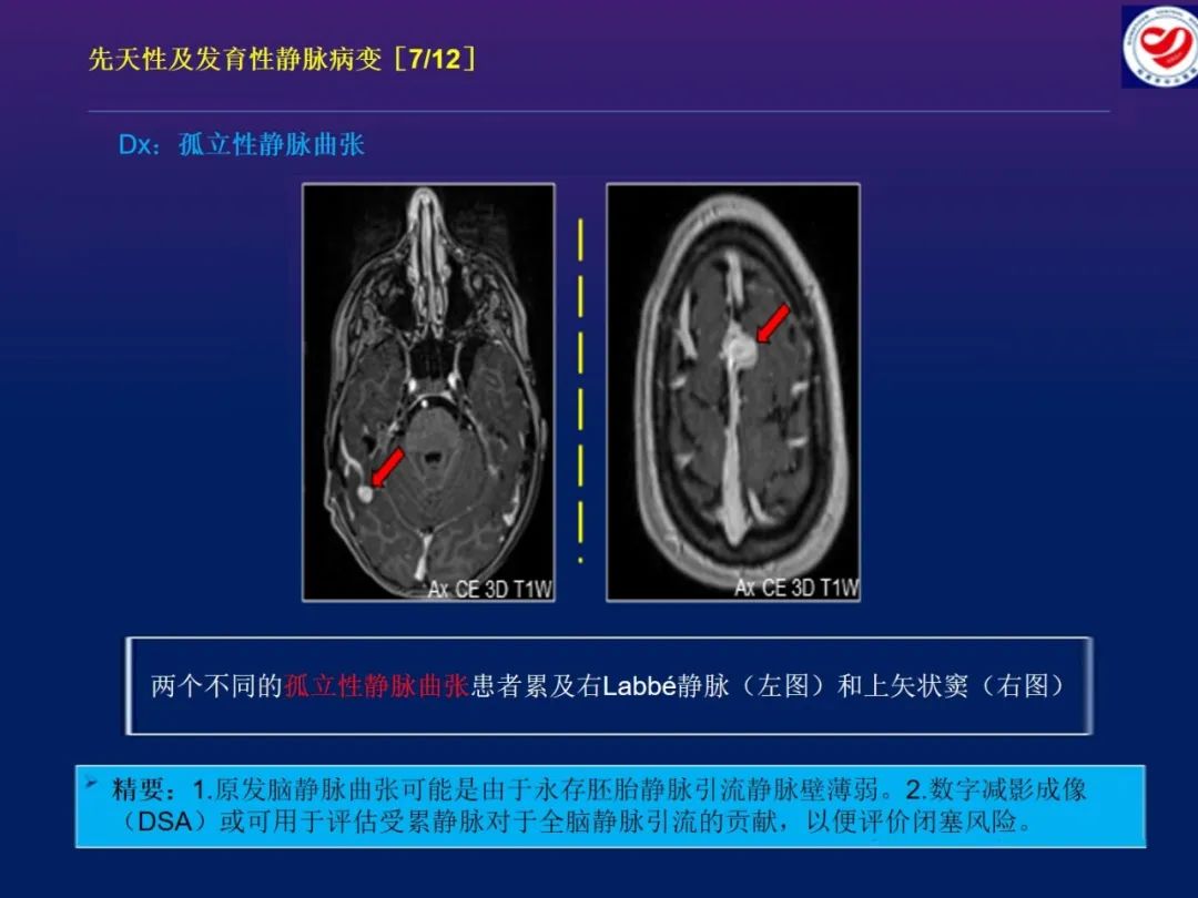 影像PPT - 【PPT】小儿脑静脉影像学：包括硬脑膜静脉窦-18