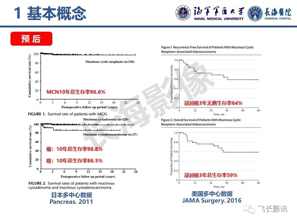 影像PPT - 【PPT】胰腺黏液性囊性肿瘤影像学评估-6
