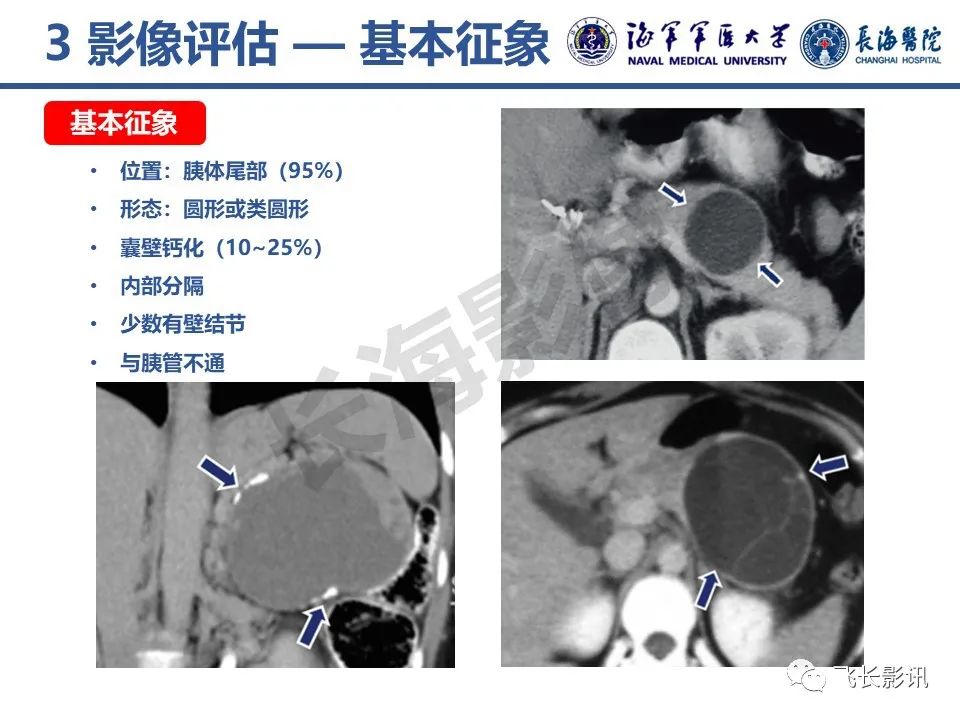 影像PPT - 【PPT】胰腺黏液性囊性肿瘤影像学评估-12