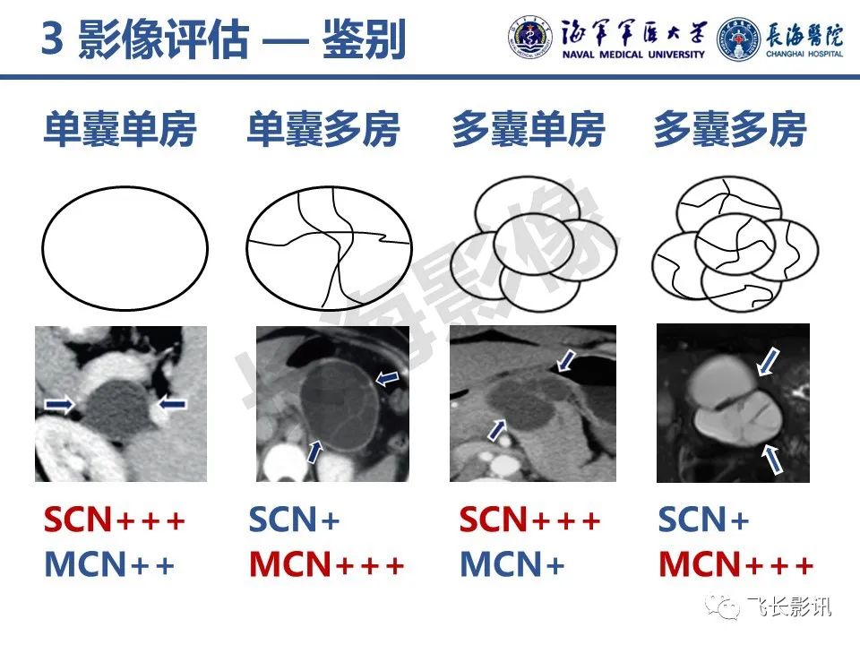 影像PPT - 【PPT】胰腺黏液性囊性肿瘤影像学评估-17