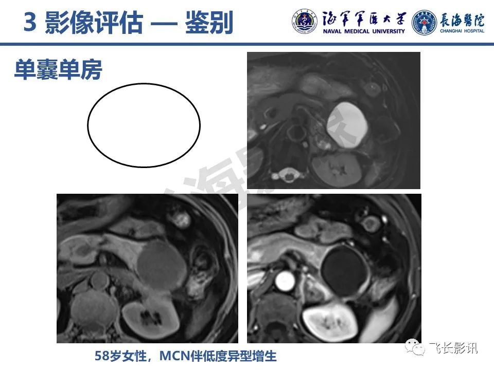 影像PPT - 【PPT】胰腺黏液性囊性肿瘤影像学评估-19