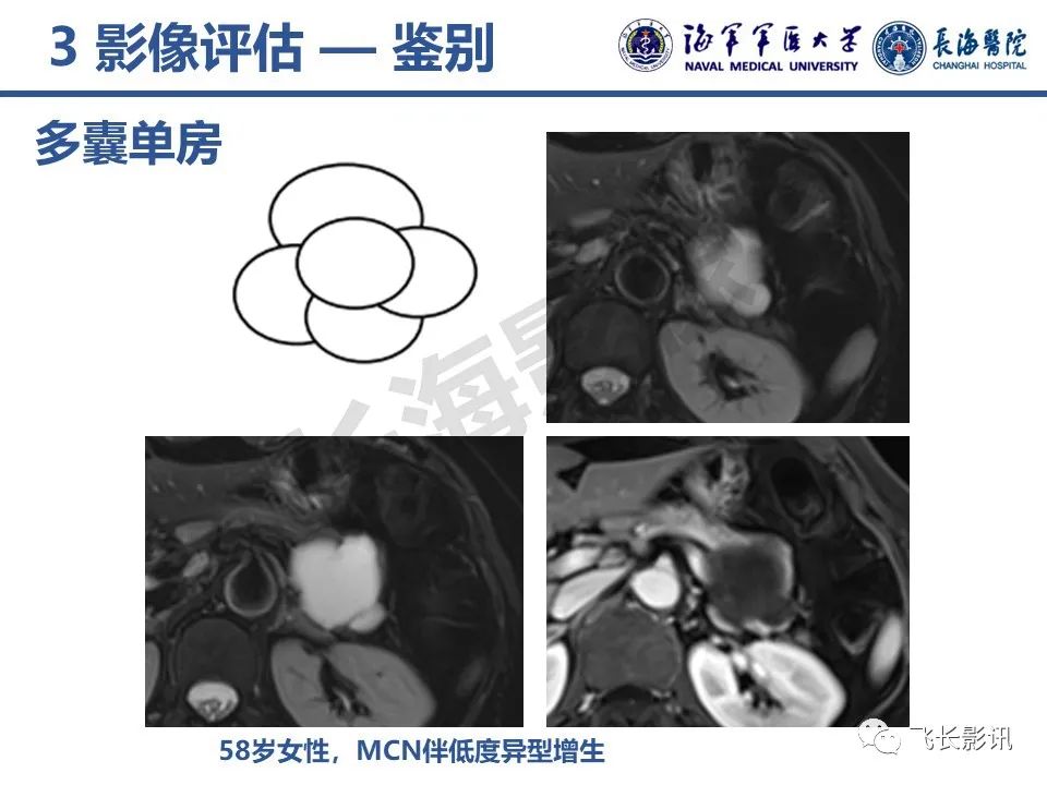 影像PPT - 【PPT】胰腺黏液性囊性肿瘤影像学评估-21