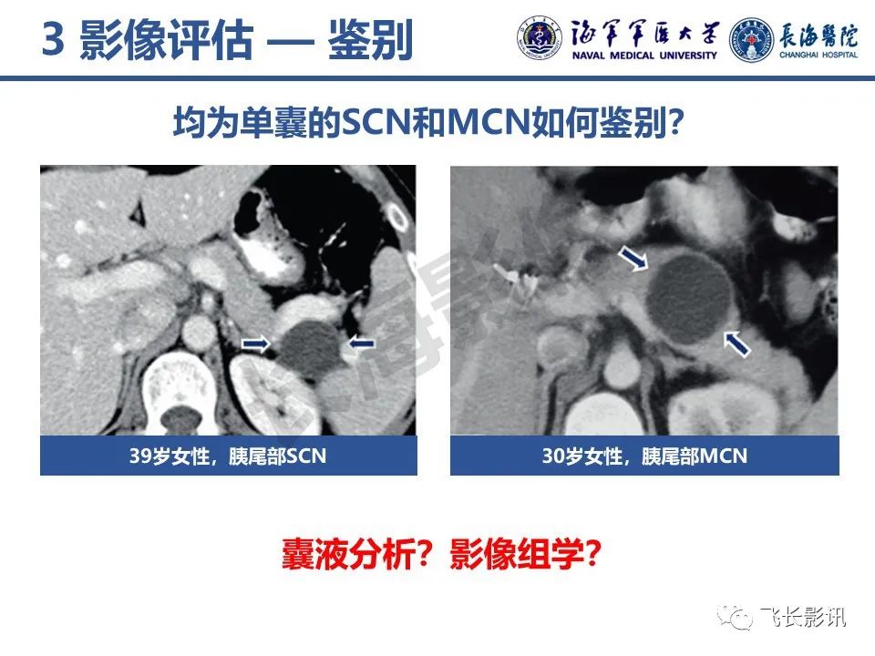 影像PPT - 【PPT】胰腺黏液性囊性肿瘤影像学评估-24