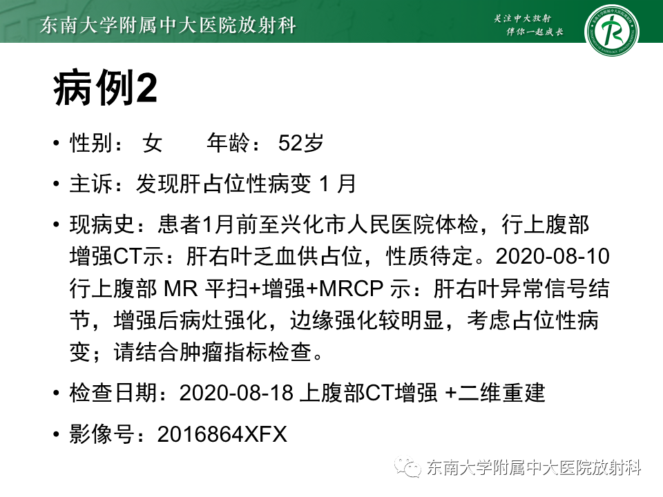 影像PPT - 【PPT】肝脏炎性肌纤维母细胞瘤-10