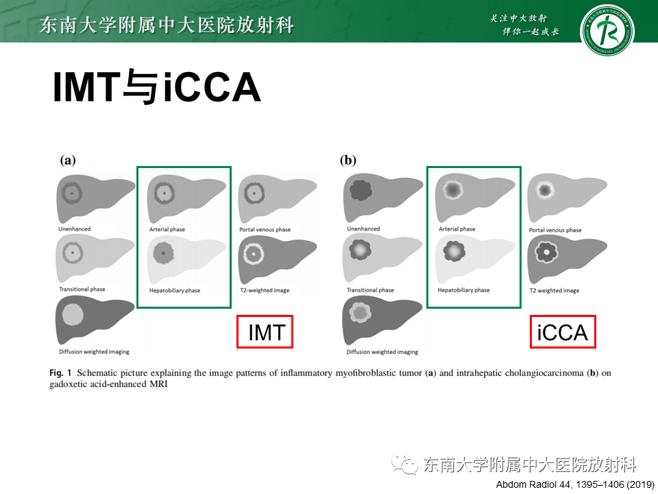 影像PPT - 【PPT】肝脏炎性肌纤维母细胞瘤-24