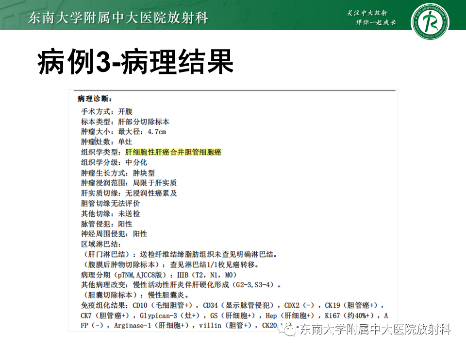 影像PPT - 【PPT】肝脏炎性肌纤维母细胞瘤-23