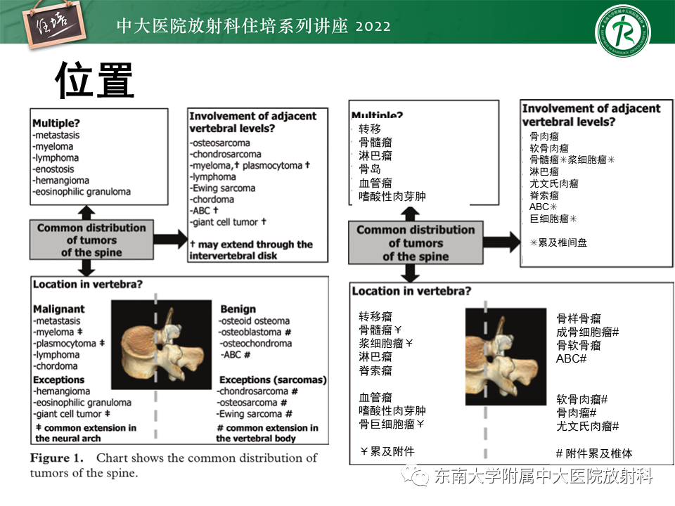 影像PPT - 【PPT】常见椎体孤立性肿瘤的诊断思路-39